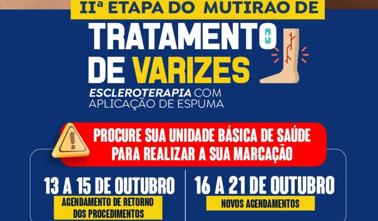 II Etapa do Mutirão de Tratamento de Varizes acontece de 22 a 24 de outubro em Miguel Calmon